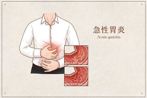 1656689842525012.jpg 攝圖網_401789692_banner_急性胃炎醫(yī)療插畫(企業(yè)商用).jpg