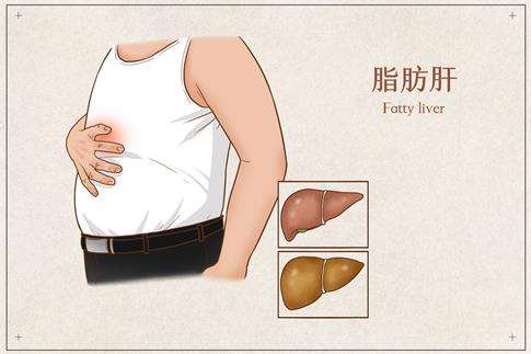 1718927263159194.jpg 攝圖網(wǎng)_401804062_脂肪肝醫(yī)療插畫(huà)(企業(yè)商用).jpg
